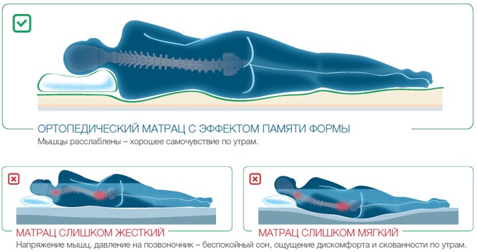 Правильное положение позвоночника во время сна